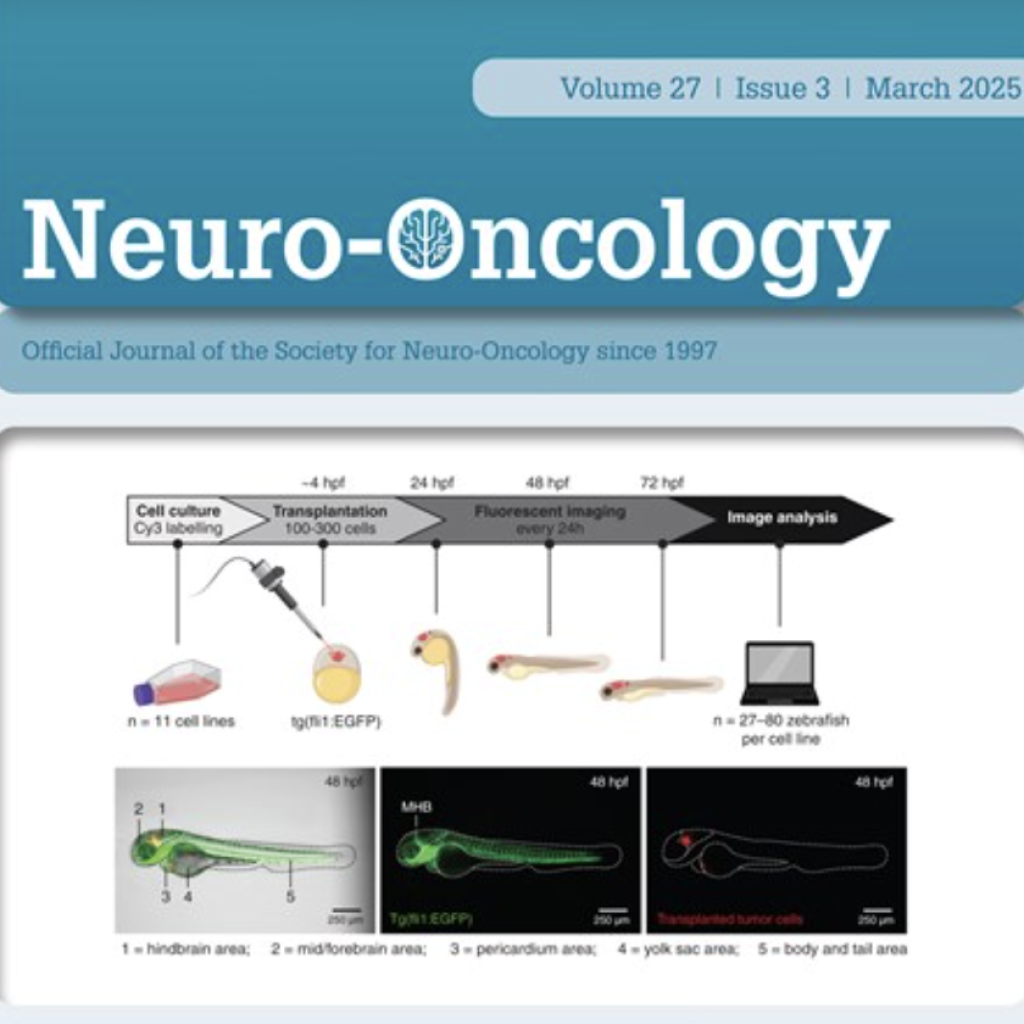 KL-50: A novel therapeutic agent targeting MGMT-deficient glioblastoma